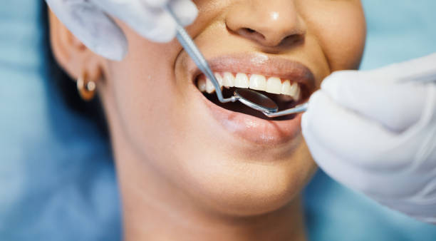 Best Emergency Dental Services for Seniors in Bladensburg, MD