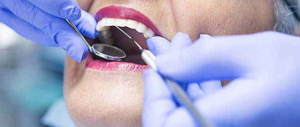 Best Emergency Dentist for Knocked-Out Tooth in Bladensburg, MD